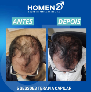 depo1