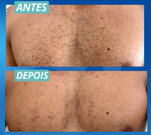 depo2